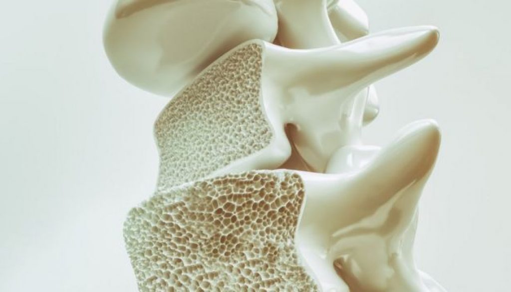osteoporose